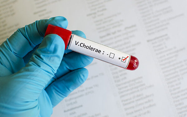 Blood sample positive with vibrio cholerae