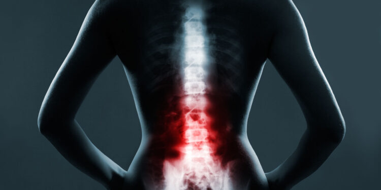 36670015 - human spine in x-ray, on gray background. the lumbar spine is highlighted by red colour.