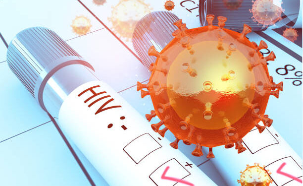 HIV test positive, hiv virus. 3d illustration