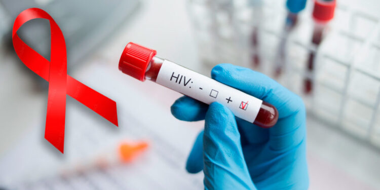 Diagnostician holding in hand a positive HIV test.