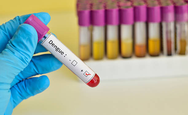 Blood sample positive with dengue virus