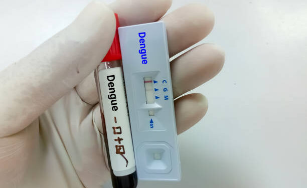 Close up view of technologist or technician glove hand hold a blood sample and rapid test cassette for dengue IgG, IgM rapid screening test